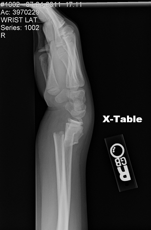 another x-ray