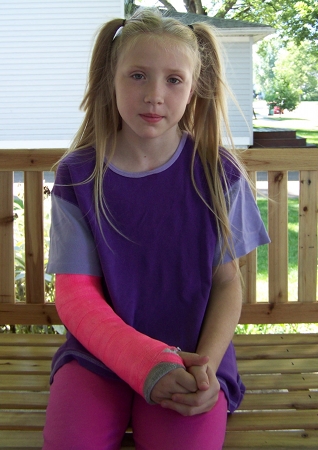 Nora in her cast